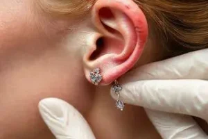 excelência em furo de orelhinha baby